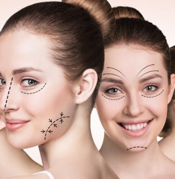 Segundo pesquisa, crescimento na busca por cirurgia facial se deve a redes sociais