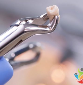 Viva com Saúde – 15/03/2023 – Extrair o dente não precisa ser traumático