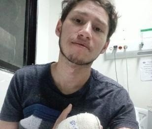 Negligência Médica: Homem perde dedo com picada de aranha, entenda o caso