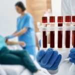 Exame de sangue detecta proteína do Alzheimer e faz diagnóstico antecipado