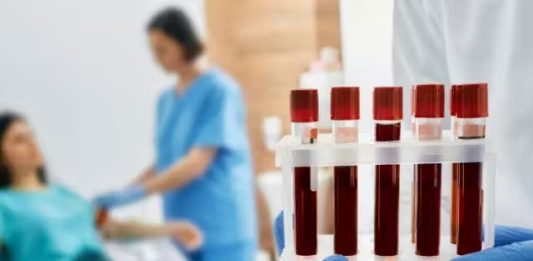 Exame de sangue detecta proteína do Alzheimer e faz diagnóstico antecipado
