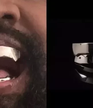 Kanye West substitui dentes por próteses de titânio de R$ 4,4 milhões