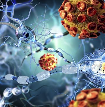 Ouro reverte dano em cérebros com Parkinson e esclerose