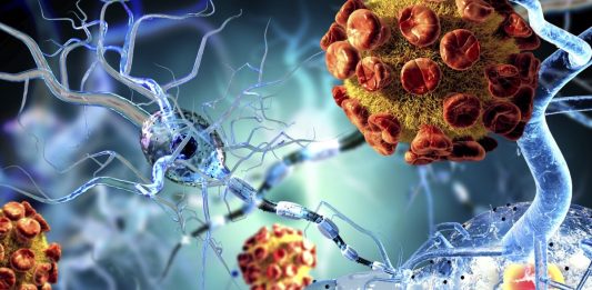 Ouro reverte dano em cérebros com Parkinson e esclerose
