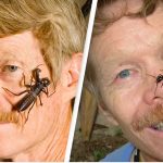 Ranking da dor: Cientista foi picado por 80 insetos para descobrir qual dói mais