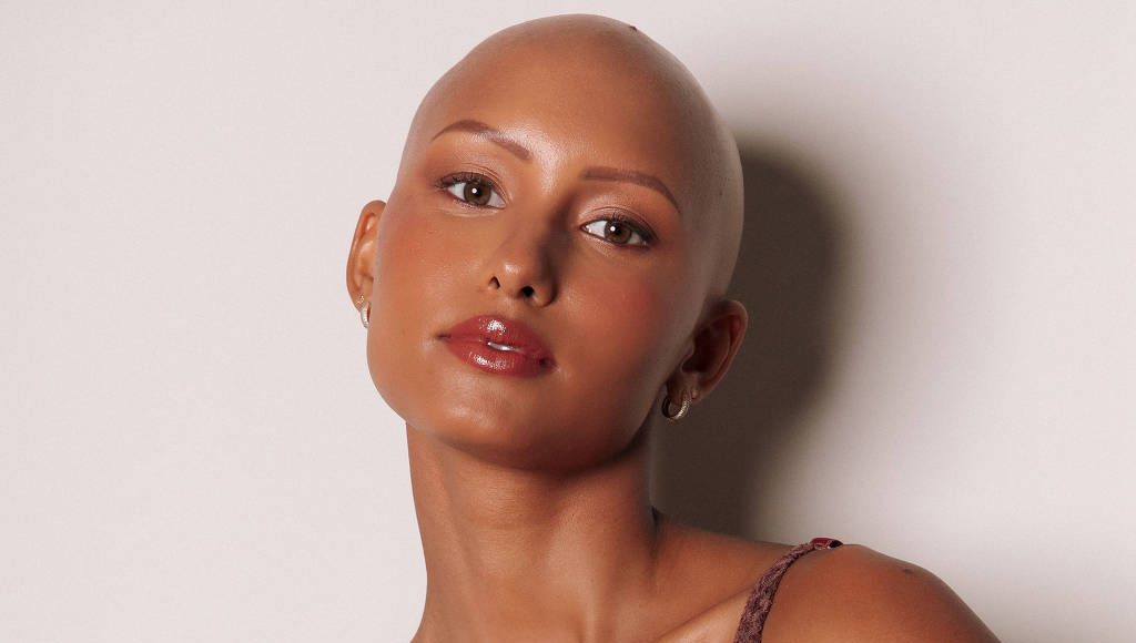 Foto: A modelo Yasmin Brito, 23, nasceu com alopecia androgenética congênita, ou seja, nunca teve cabelo/Arquivo pessoal