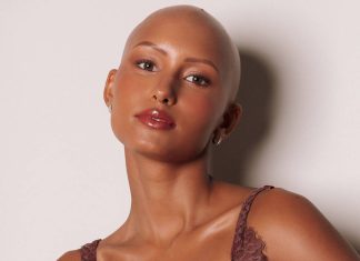 Foto: A modelo Yasmin Brito, 23, nasceu com alopecia androgenética congênita, ou seja, nunca teve cabelo/Arquivo pessoal