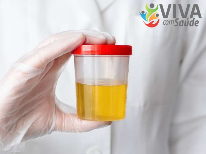 Viva com Saúde – 23/07/2024 – Cor da urina pode revelar doenças e hábitos alimentares