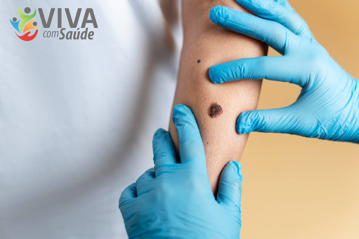 Viva com Saúde – 22/01/2026 – Tratamentos contra o câncer de pele